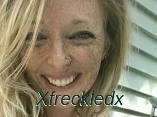 Xfreckledx